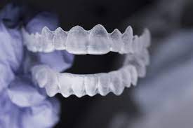 fixed clear braces