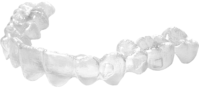 motto clear aligners