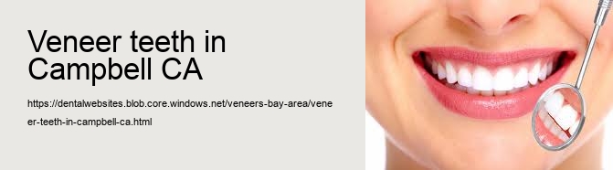 veneer teeth in Campbell CA