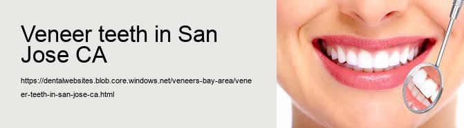 veneer teeth in San Jose CA